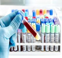 Tubo de Coleta de Sangue a Vacuo